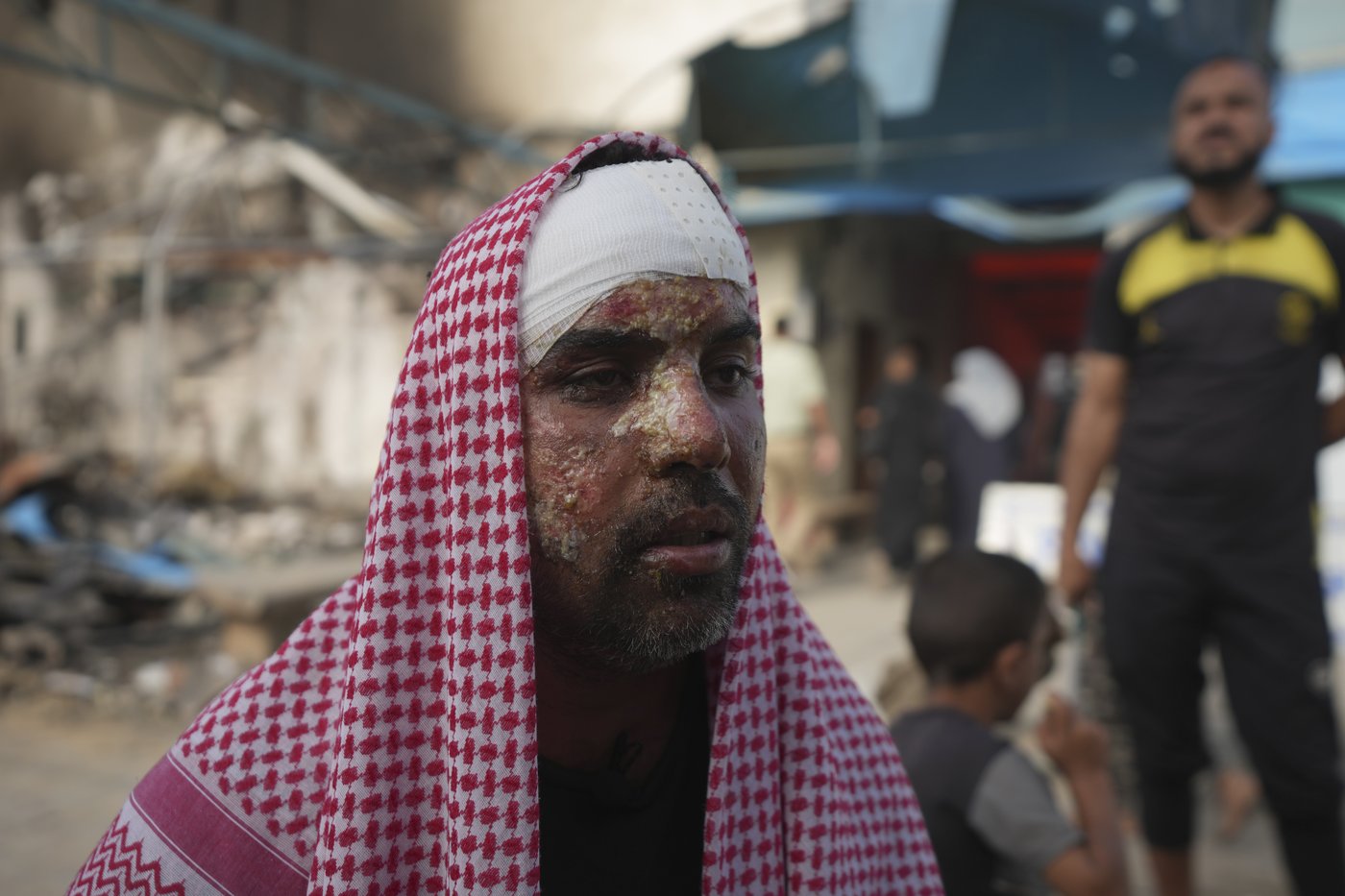 A Palestinian student was asleep in his tent at a hospital when an Israeli strike brought an inferno | iNFOnews.ca