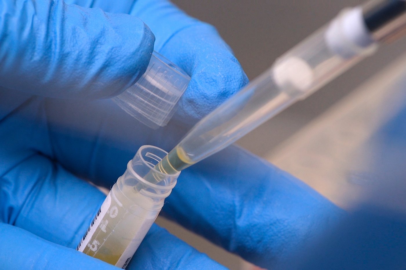 NIH funding cuts have affected over 74,000 people enrolled in experiments, a new report says | iNFOnews.ca