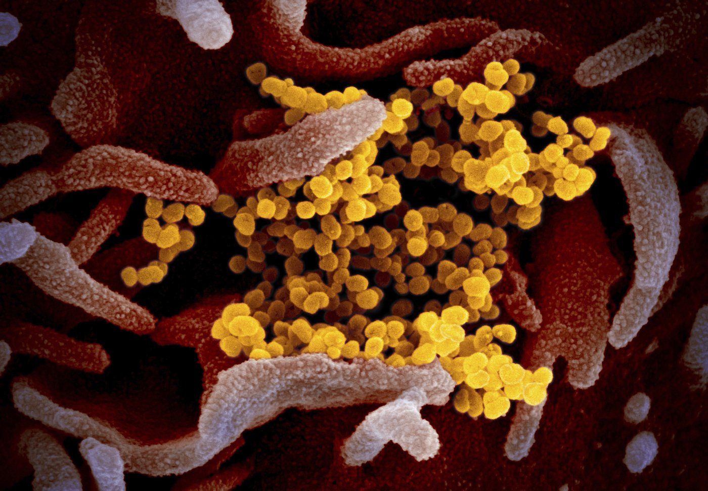 5 things we know and still don't know about COVID, 5 years after it appeared | iNFOnews.ca