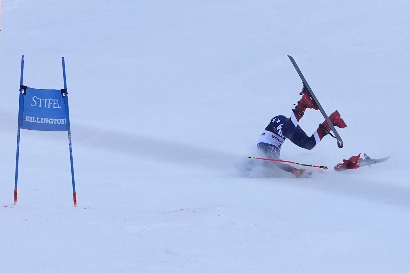 Mikaela Shiffrin suffers abdominal puncture wound but no bone or ligament damage in Killington crash | iNFOnews.ca Mikaela Shiffrin suffers abdominal puncture wound but no bone or ligament damage in Killington crash | iNFOnews.ca